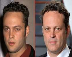 Vince Vaughn before surgery